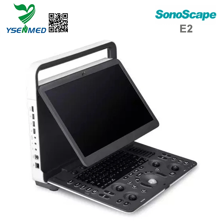 Sonoscape E2 Medizinische Geräte hochwertiger digitaler Laptop-Herzultraschall Scanner