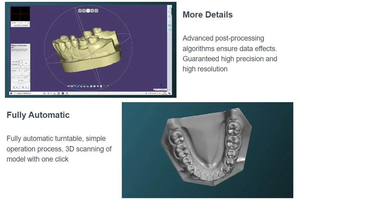 Modelo de lector portátil Ios Scaner Dental Laboratorio dental escáneres 3D