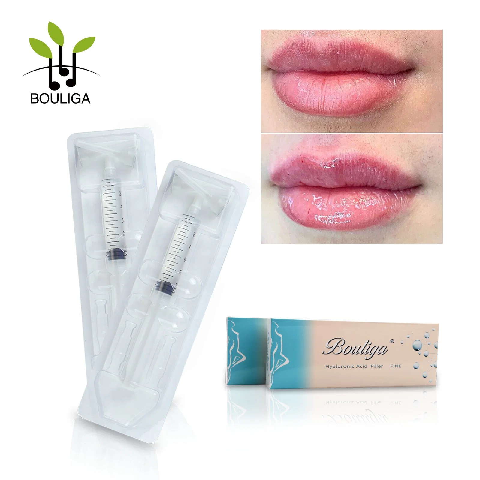 Bouliga Cross Linked Ha 10ml Recommend You Our Top-Rated Dermal Filler for Lips