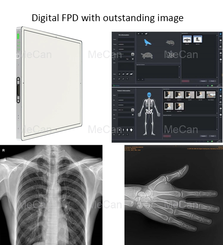 Hospital parado la máquina de rayos x para Middle-Aged Digital y antiguos