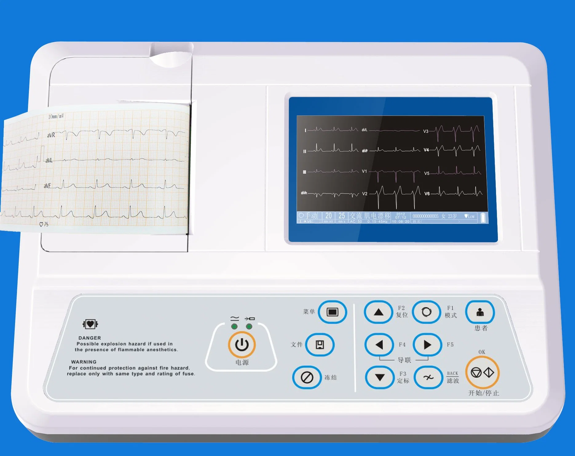 Máquina de ECG de 3 canales con aprobación CE/ISO para hospital (EKG03A)