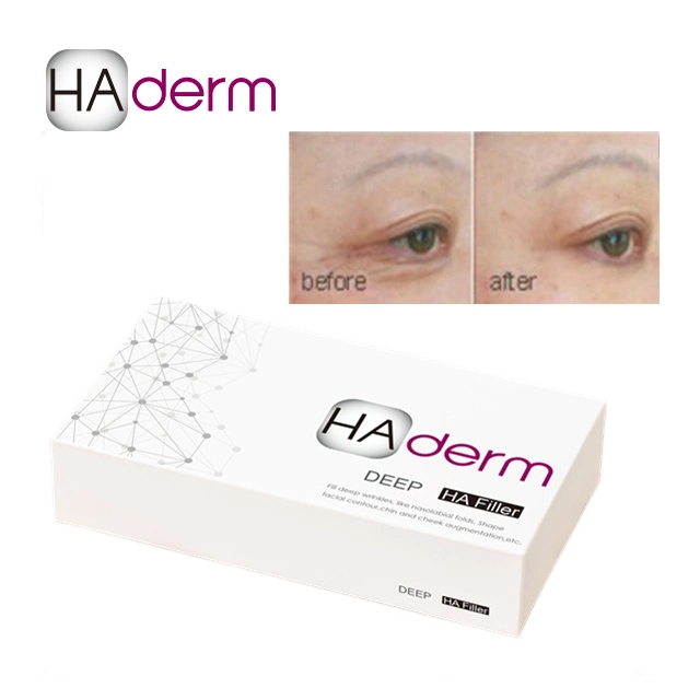 1ml 2ml 10ml 20ml Relleno dérmico de ácido hialurónico para inyección de líneas finas/derm/deep Ha Derm Filler.