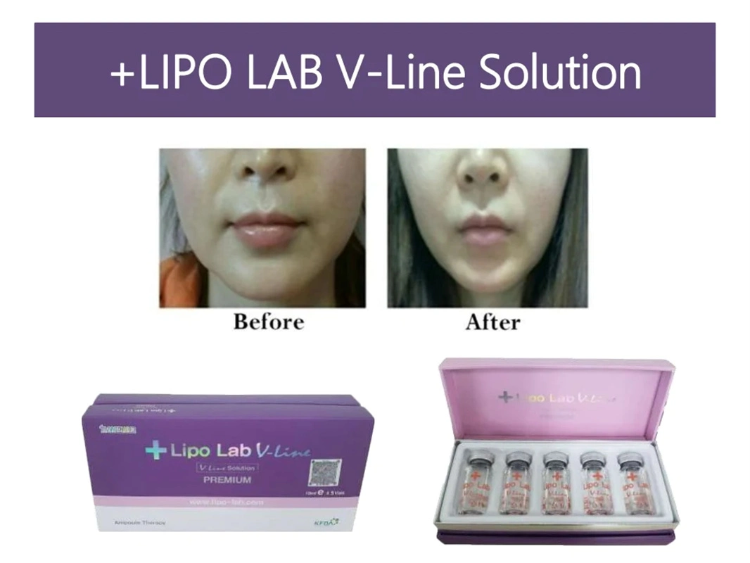 Lipolab V-ligne 5x10ml éliminent les matières grasses désoxycholique acide gras d'injection de la dissolution d'injections Lipo Lipo Slim Lab Vénus