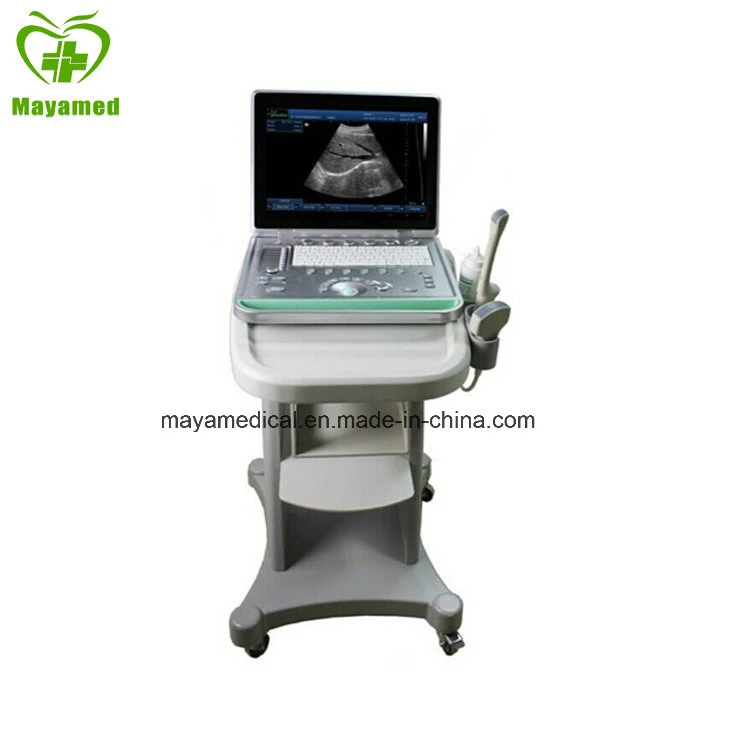 My-A009 15inch Screen PC Based Laptop Ultrasound B Scanner