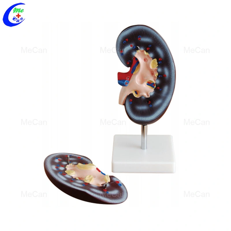 Enlarged Human Kidney Model with Adrenal Gland