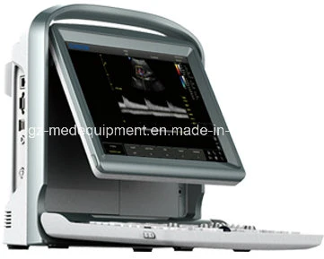 Color Doppler Medical Equipment 2D 3D 4D Portable Ultrasound Scanner (7 Models for your Choice)