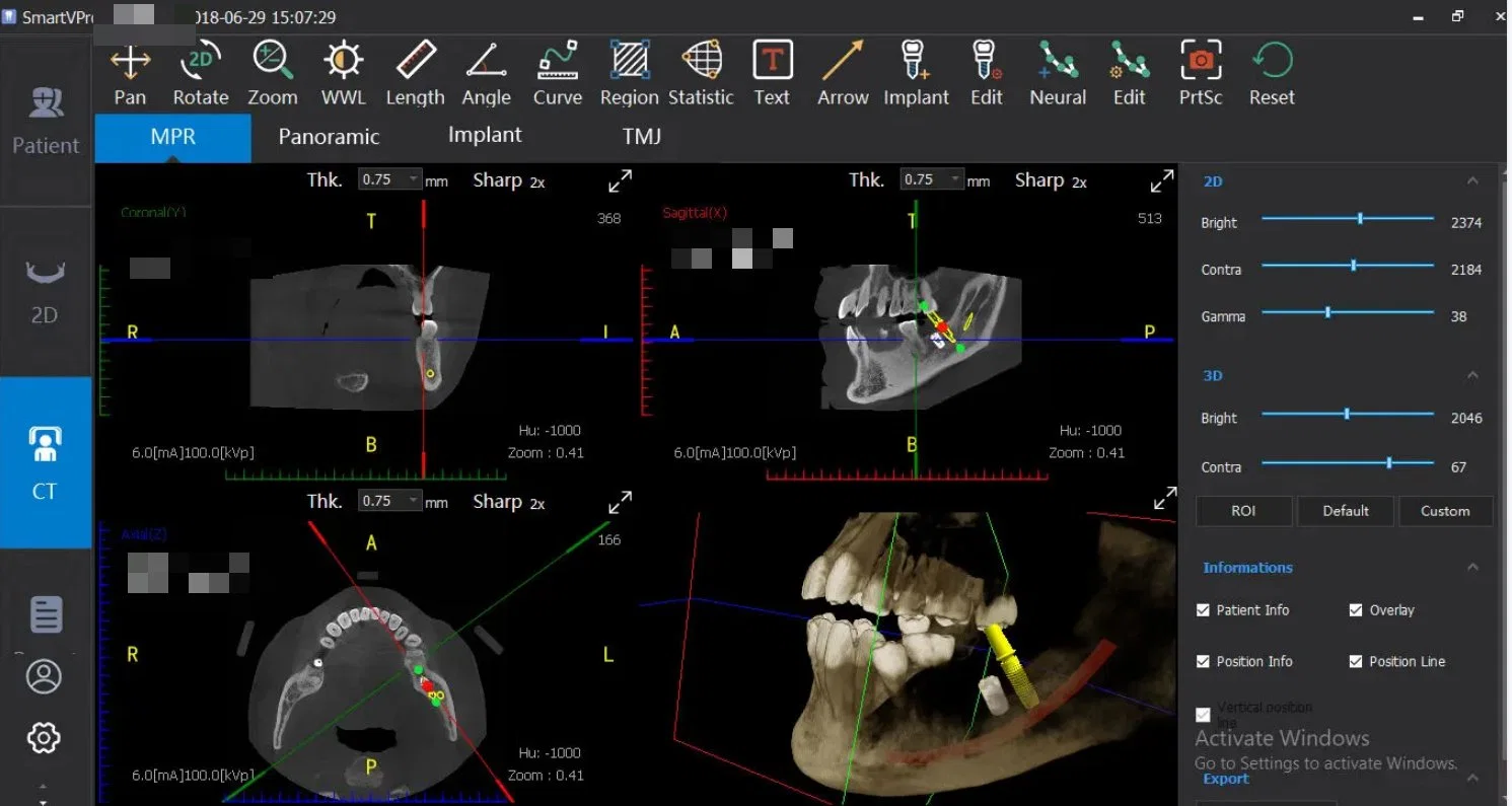 Smart 2D 3D de la Clínica Hospital Dental cefalométrico panorámico Digital Imaging Cbct dispositivo tomográfica de rayos X dentales para Ortodoncia con certificado CE dispositivo