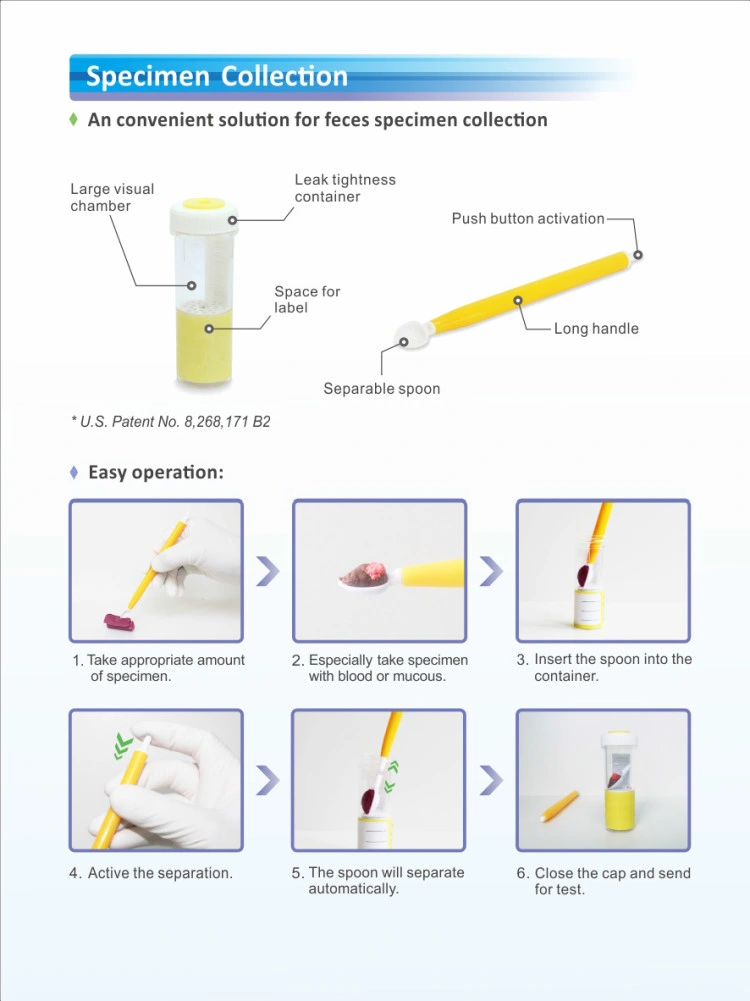 Mi-B018e sistema de análisis de las bacterias fecales coliformes fecales de la rutina automática de Inmunología del analizador de HECES HECES