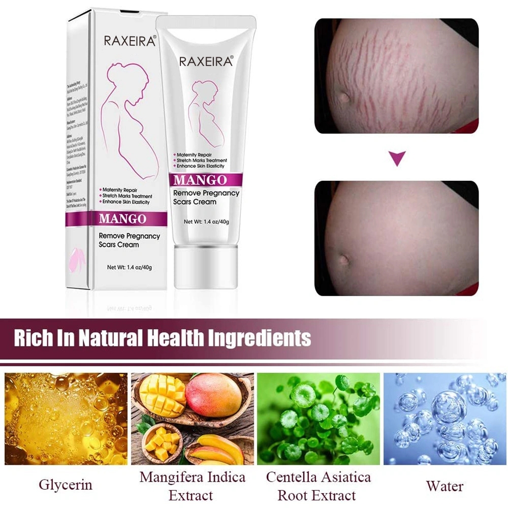 Wholesale/Supplier Scar Post-Natal Repair and Anti-Obesity Growth Lines and Pregnancy Lines Repair Cream