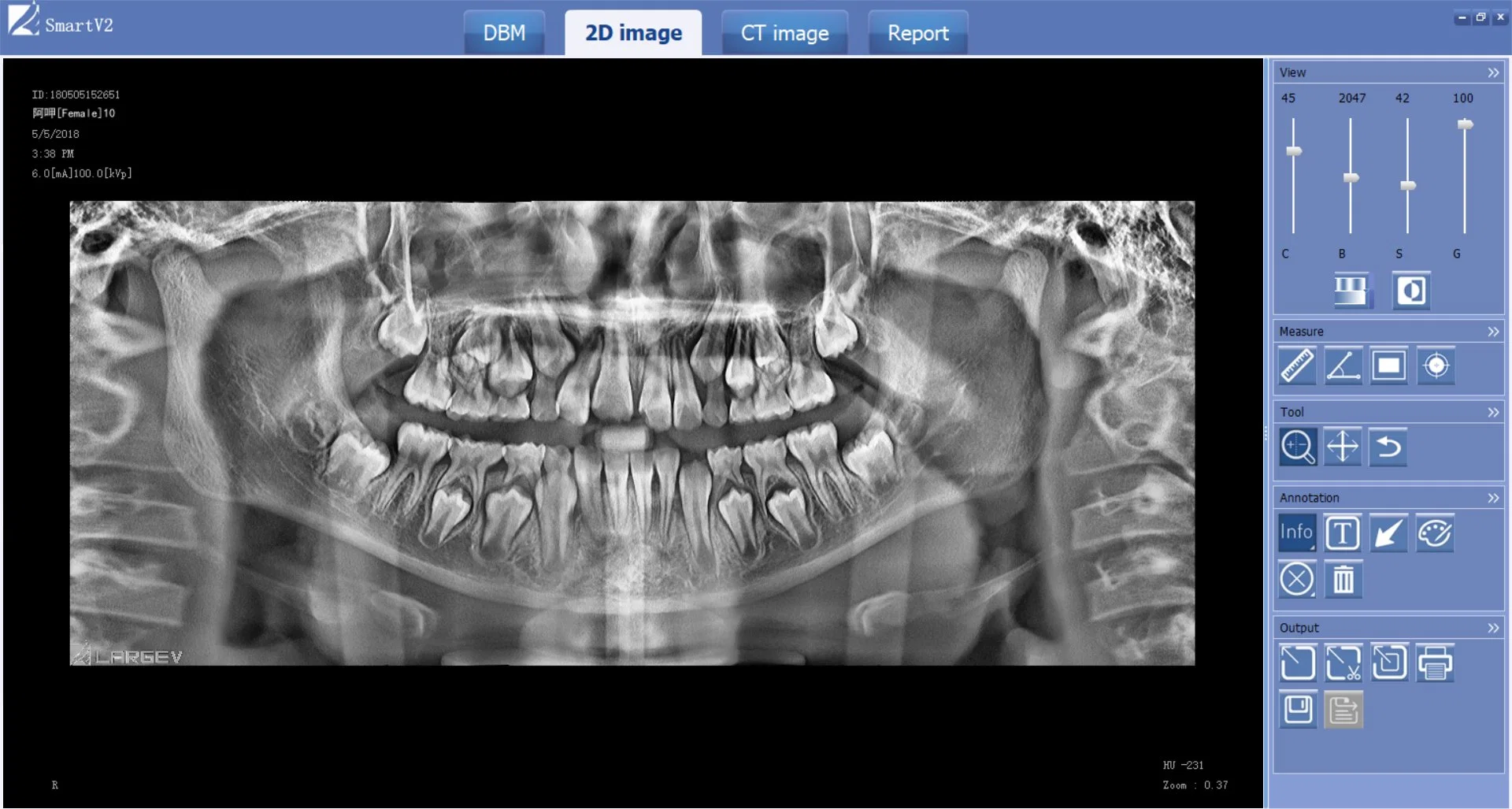 3D Dental Panoramic Xray Machine Cbct Dental X Ray Machine Dental Equipment