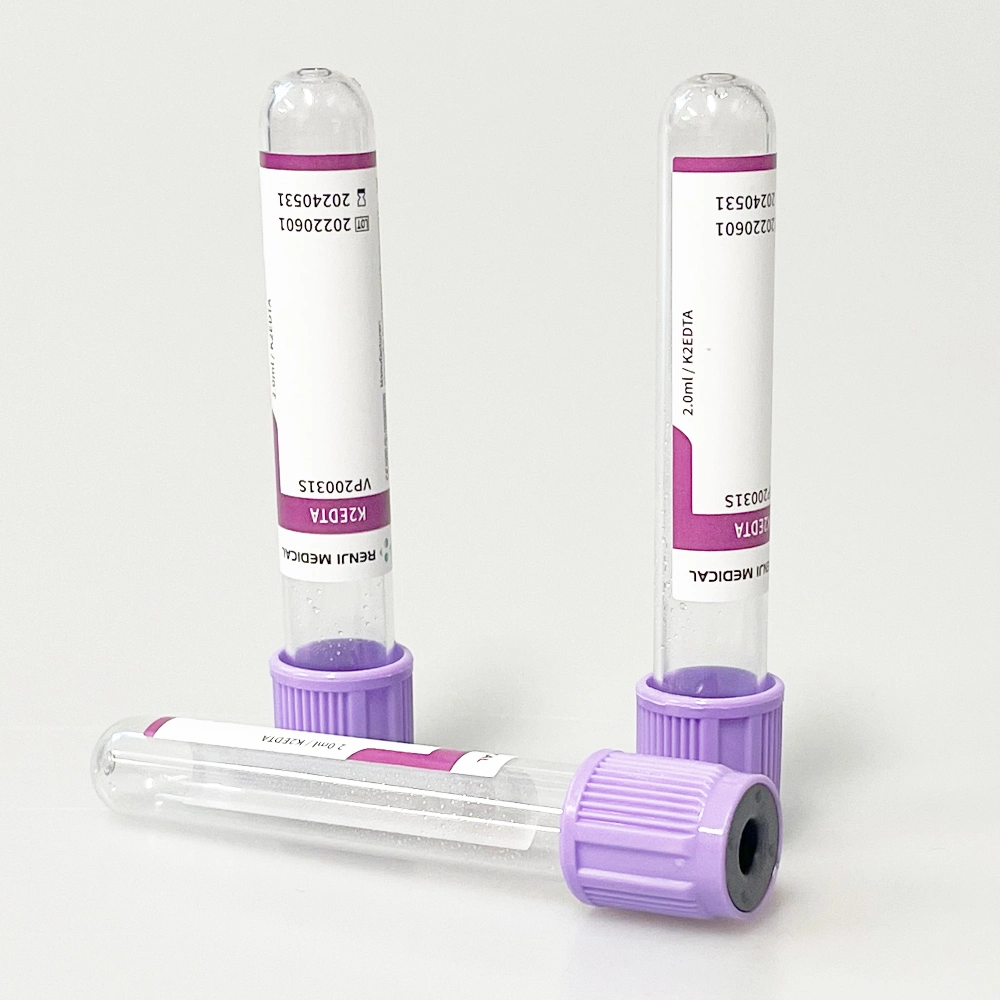 Consumibles médicos proveedor EDTA tubos de recolección de sangre para uso hospitalario