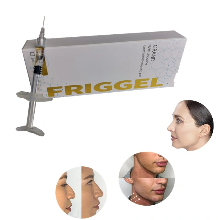 Factory Price Hyaluronic Acid Friggel Deep Anti Wrinkle Lifting Injection