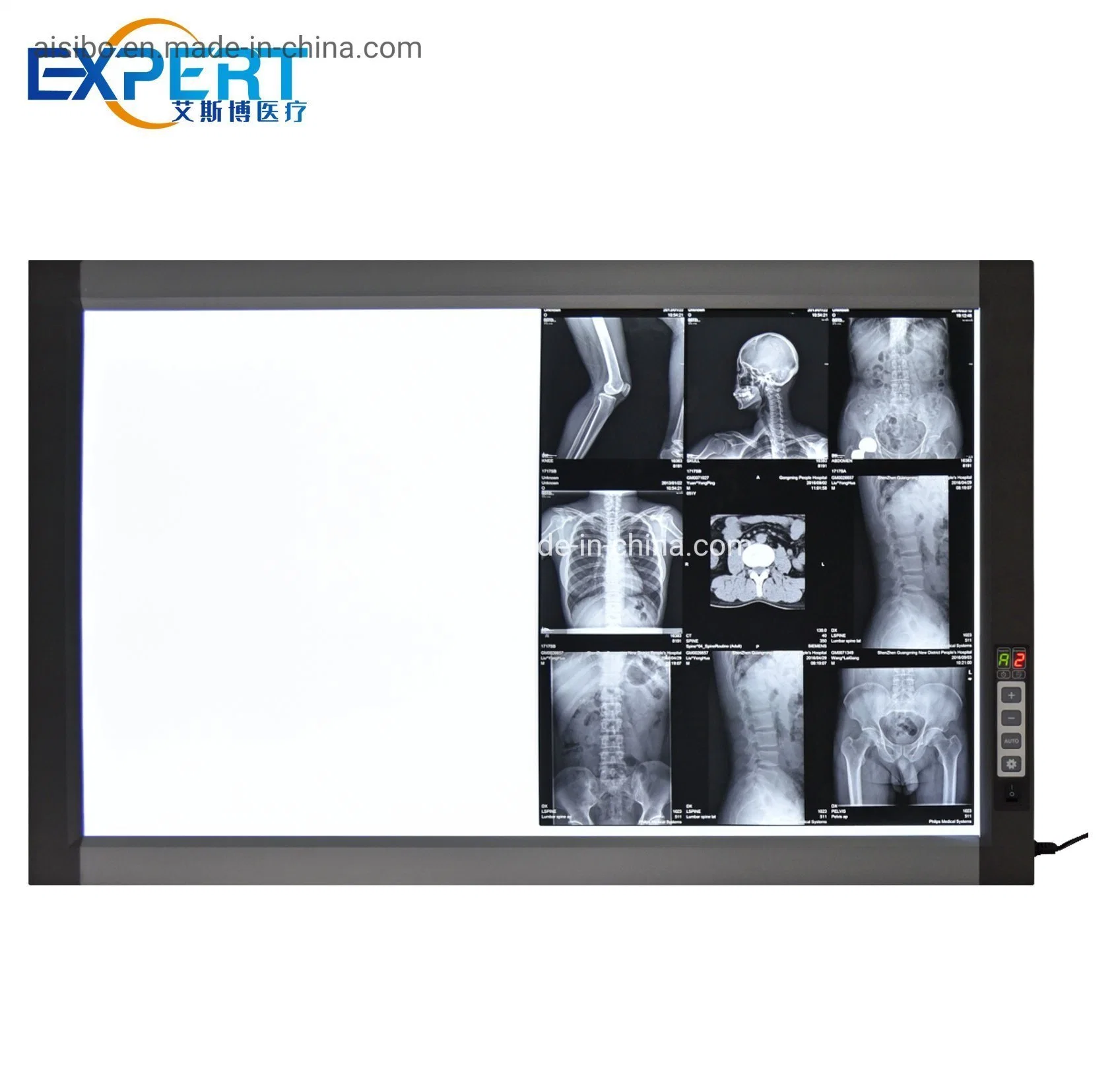 Medizinisches Krankenhaus Negatoskop Röntgenaufnahme Dental X-ray Film Viewer Röntgenaufnahme Box Medizinprodukt