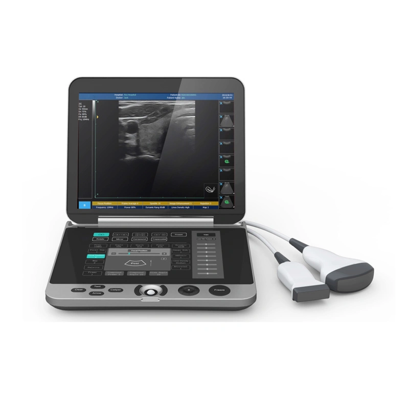 Medizinische Diagnosegereichte Laptop Farbdoppler Ultraschallscanner