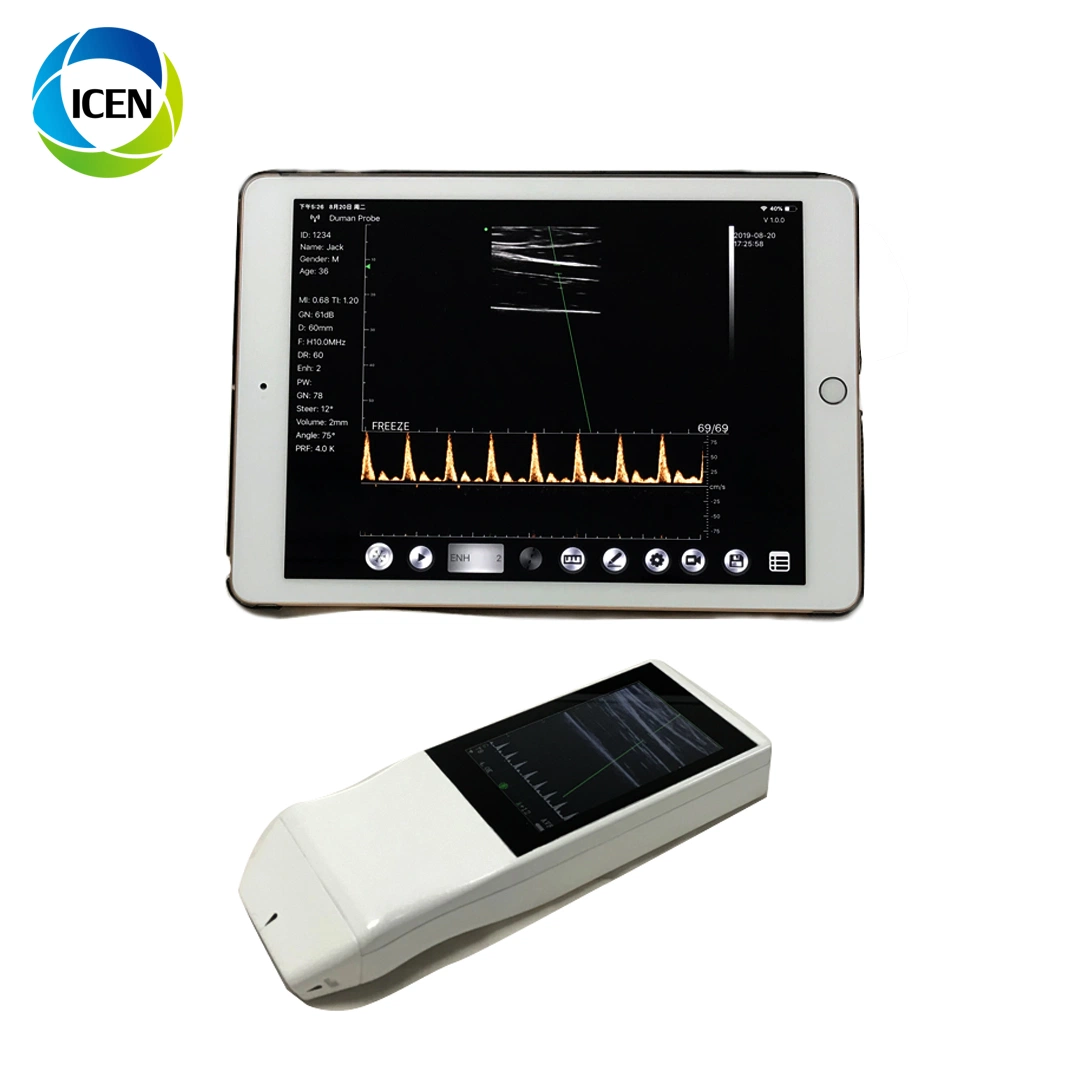 in-A051 Handheld Diagnostic Color Doppler USG Echo Scanner Wireless Probe Scanner with Screen Low Price