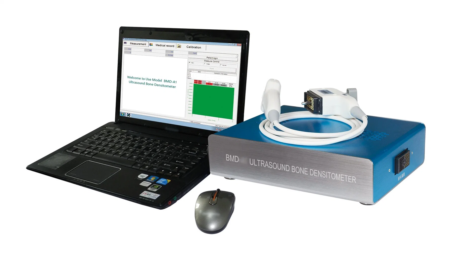 Automatic High Effective Ultrasound Bone Densitometer