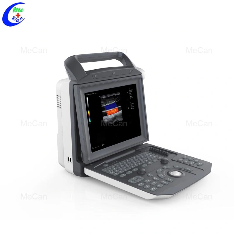 Advance Echo Cardiology Full Digital Echographe Portable Color Doppler Ultrasound Scanner with Good Price