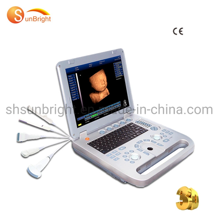 Sunbright Brand Win 7 System Medical 3D Laptop Ultrasound Scanner