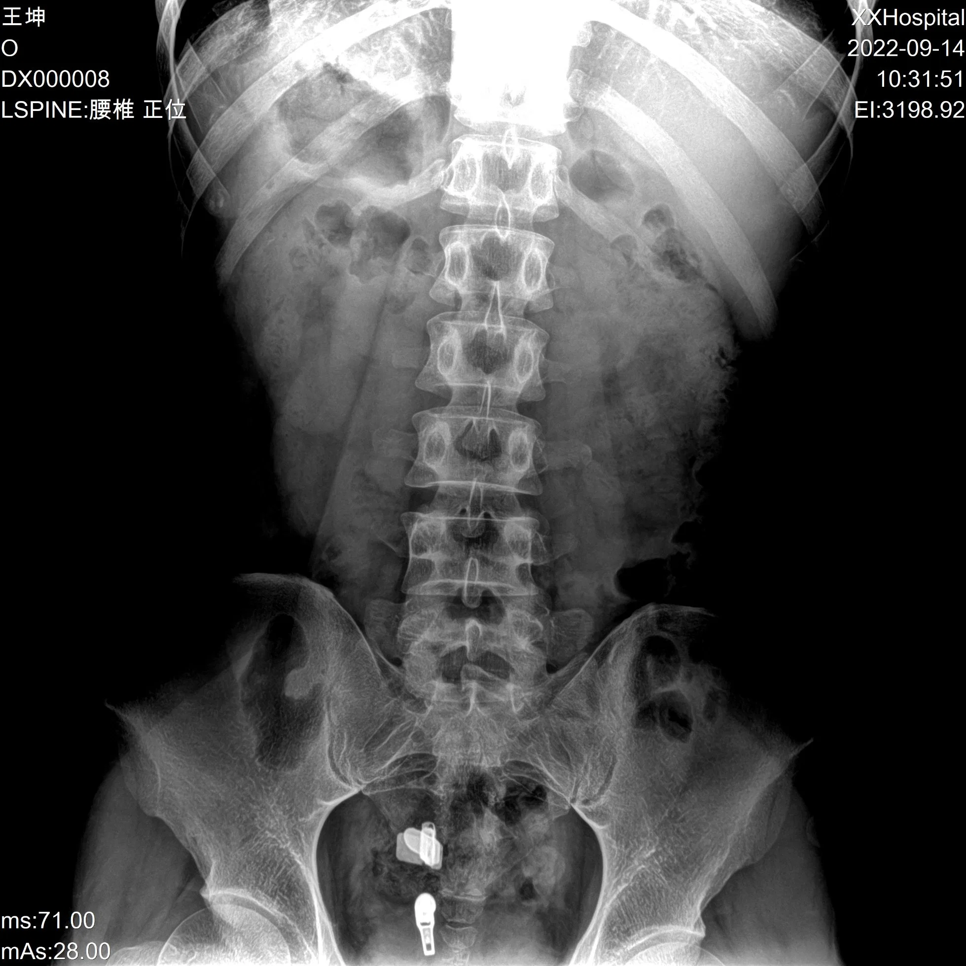 Sistema de radiografía digital de rayos X rd-832X a su alcance