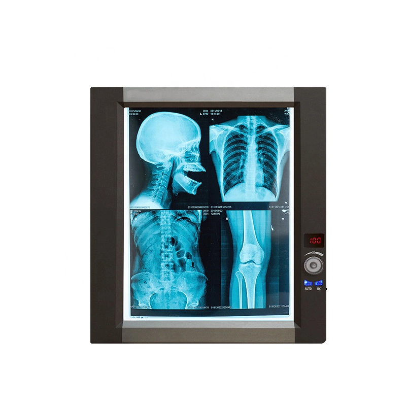 Slim Portable LED en médecine dentaire Negatoscope X-ray Lecteur Film Viewer