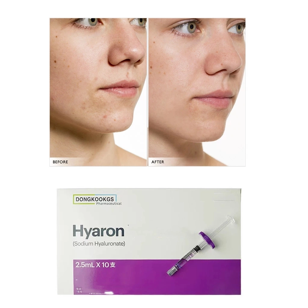 Korea Dongkook Hyaron Whitening Skin Care Mesotherapie Lösung Haut Befeuchten Anti-Falten