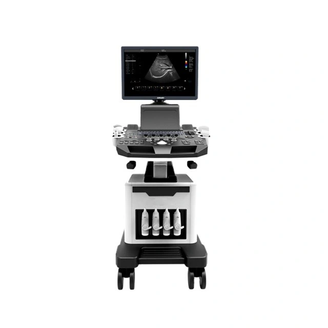 Hospital Professional Digital Color Doppler Ultrasound Scanner System (3D/4D)
