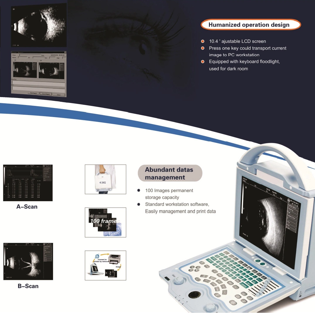 Portable Biometry Accuracy Full Digital Ophthalmic a/B Ultrasound Scanner