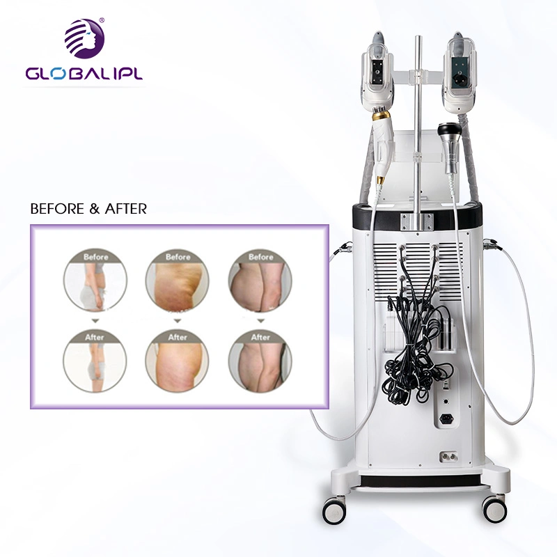 Double Cavitation Vacuum Liposuction Rolling Machine RF Vacuum Rollers Body Slimming Fat Losing Equipment