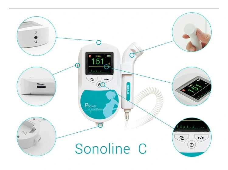 Fetal Heart Doppler Detector-Color Display (Sonoline C)