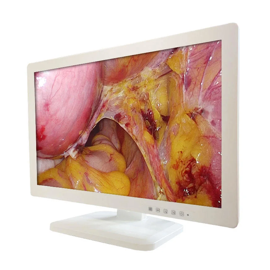 24-Inch HD Medical Grade Monitor for Endoscopy Use