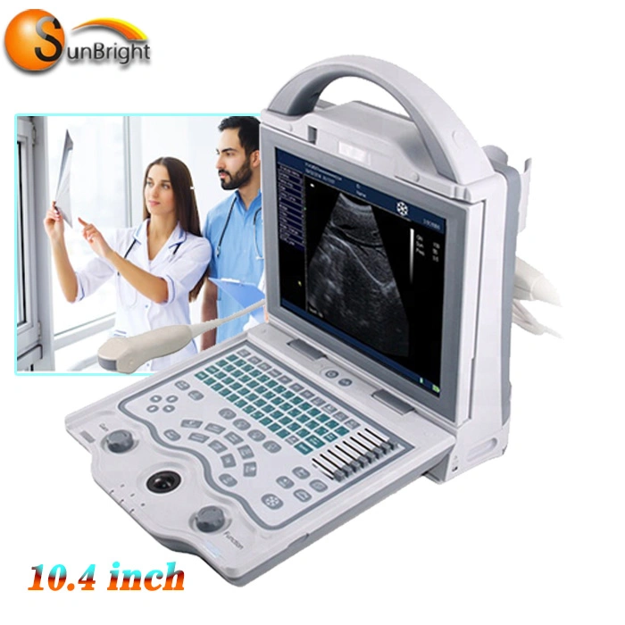 Trending Hot Ultrasound Scan Supplier 10.4 Inch Display Laptop Full Digital Portable Ultrasound