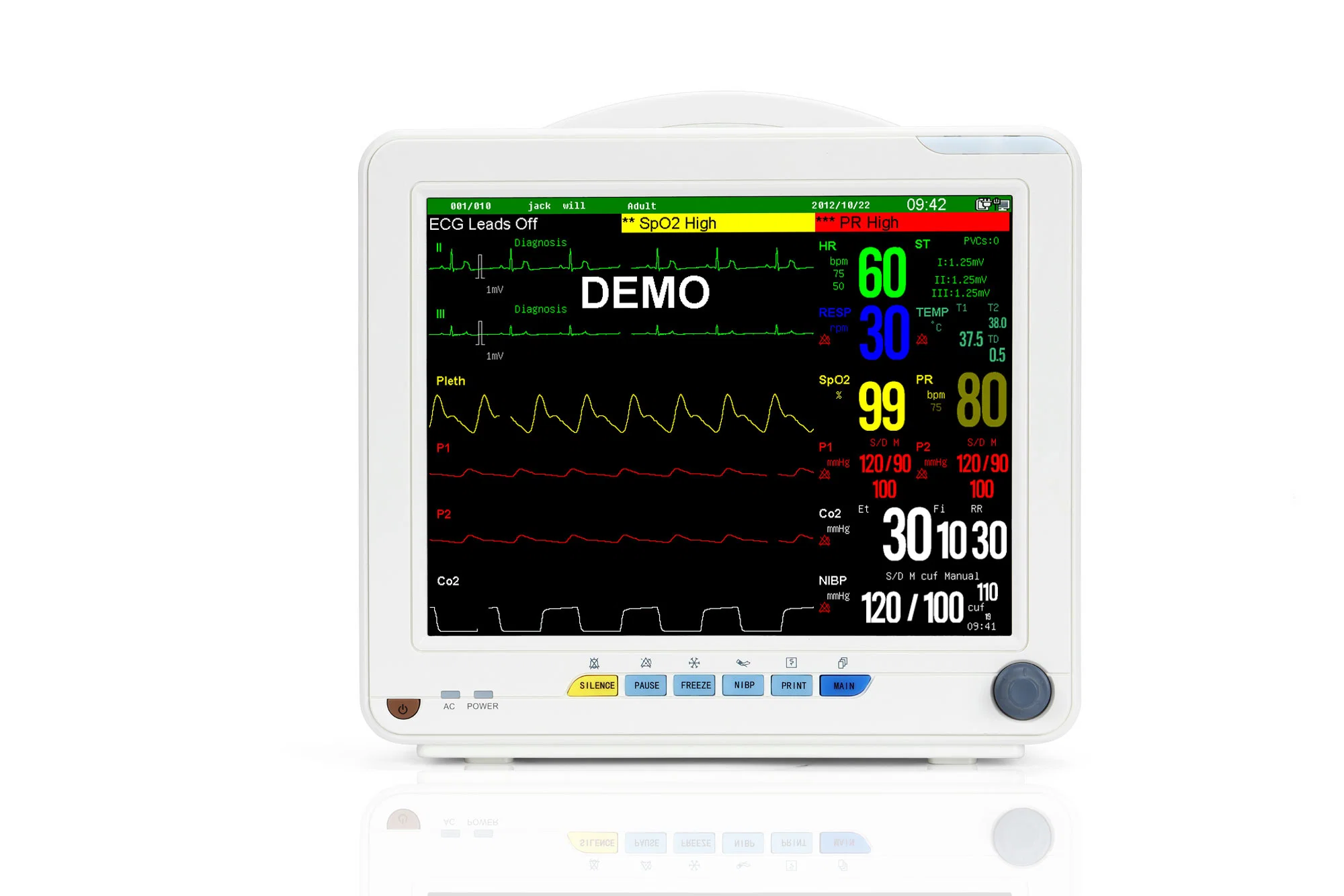 Sinnor Snp9000n 12,1 pulgadas multi-para Monitor de paciente de cabecera