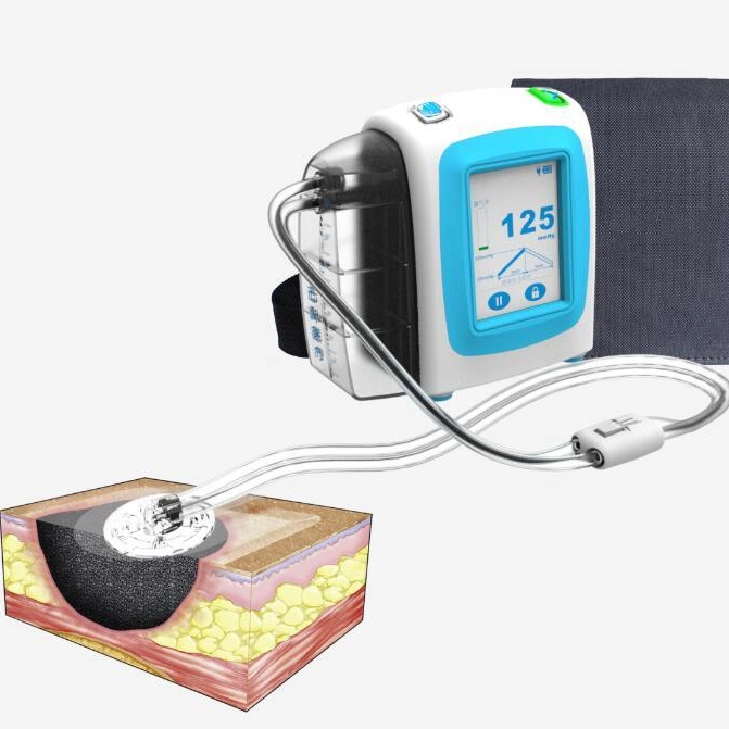الأجهزة الطبية الأجهزة المصنعة نظام العلاج بالضغط السلبي الجوفي
