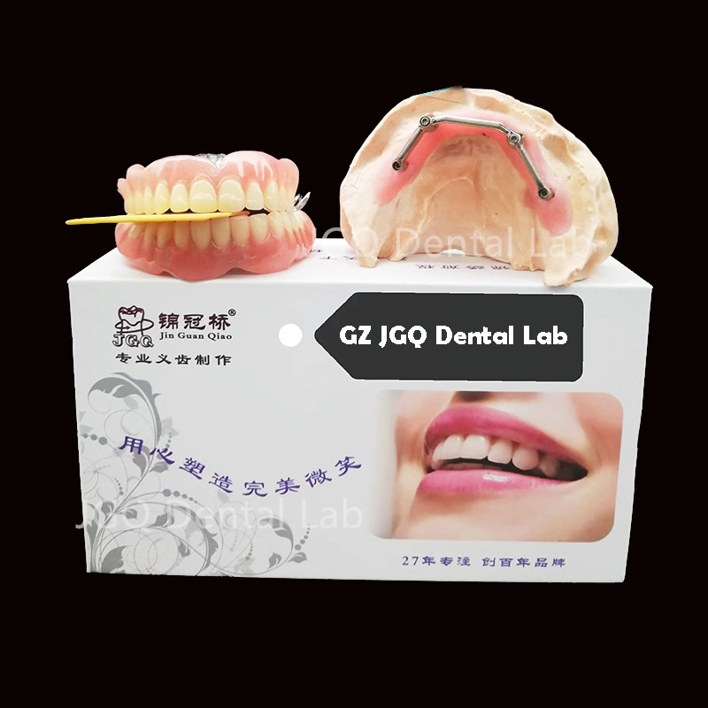 All on 4 Dental Prosthesis Titanium Implant Supported Overdenture Bar