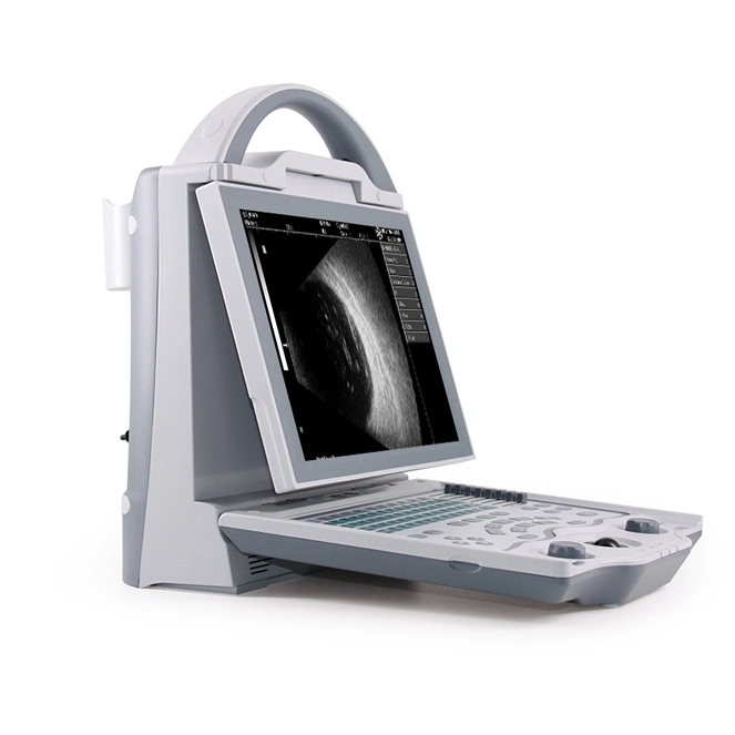 Portable Biometry Accuracy Full Digital Ophthalmic a/B Ultrasound Scanner