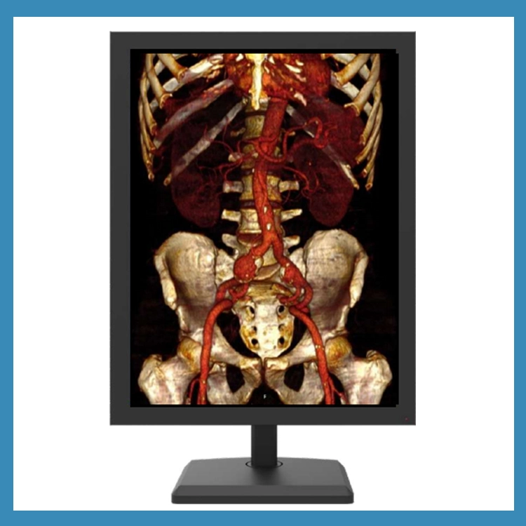 Top Quality Diagnostic Medical Display 3MP Color Medical Display with 3c