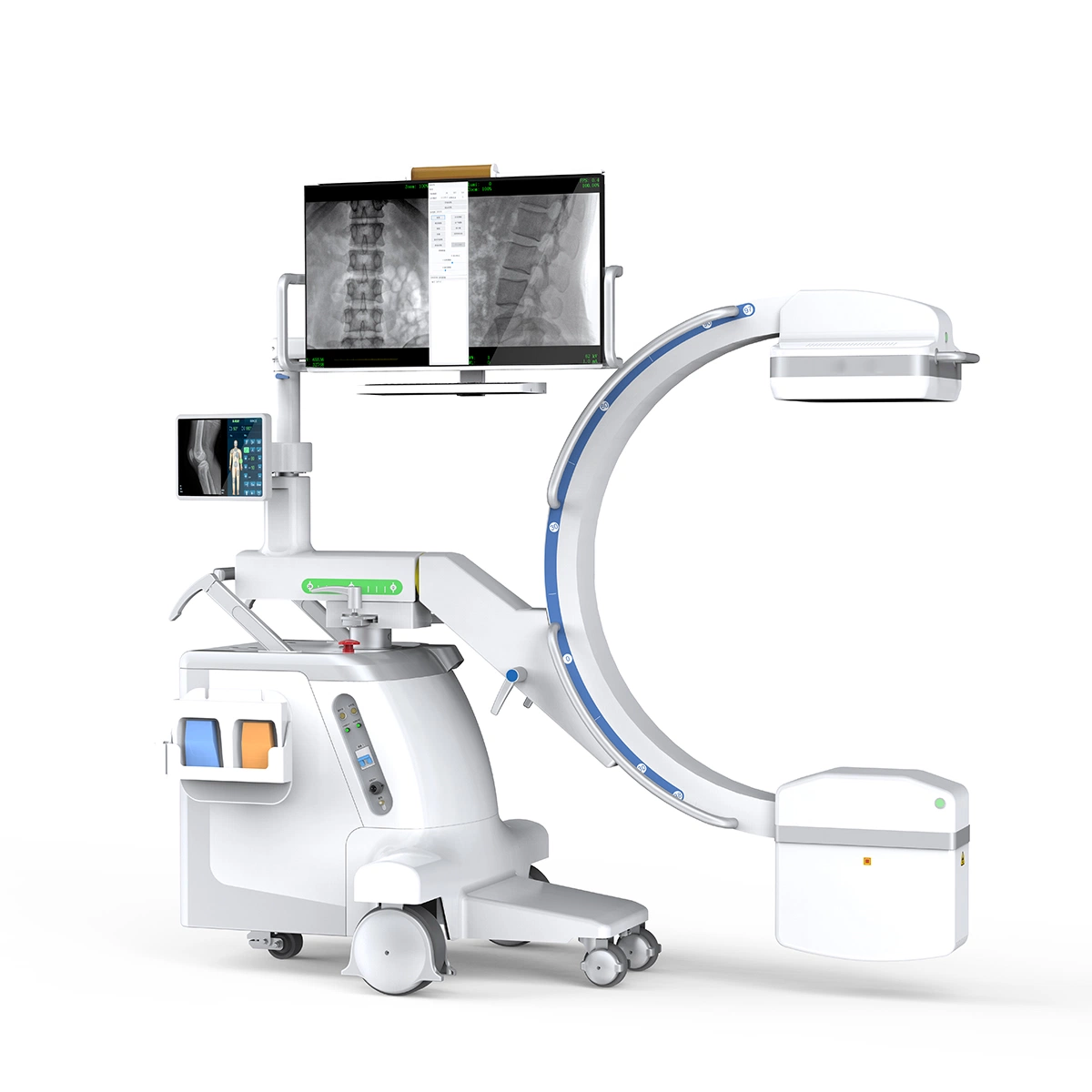 High Frequency Mobile All in One C Arm System with Fpd, Hospital Equipment for Orthopedics Urology Gynecology