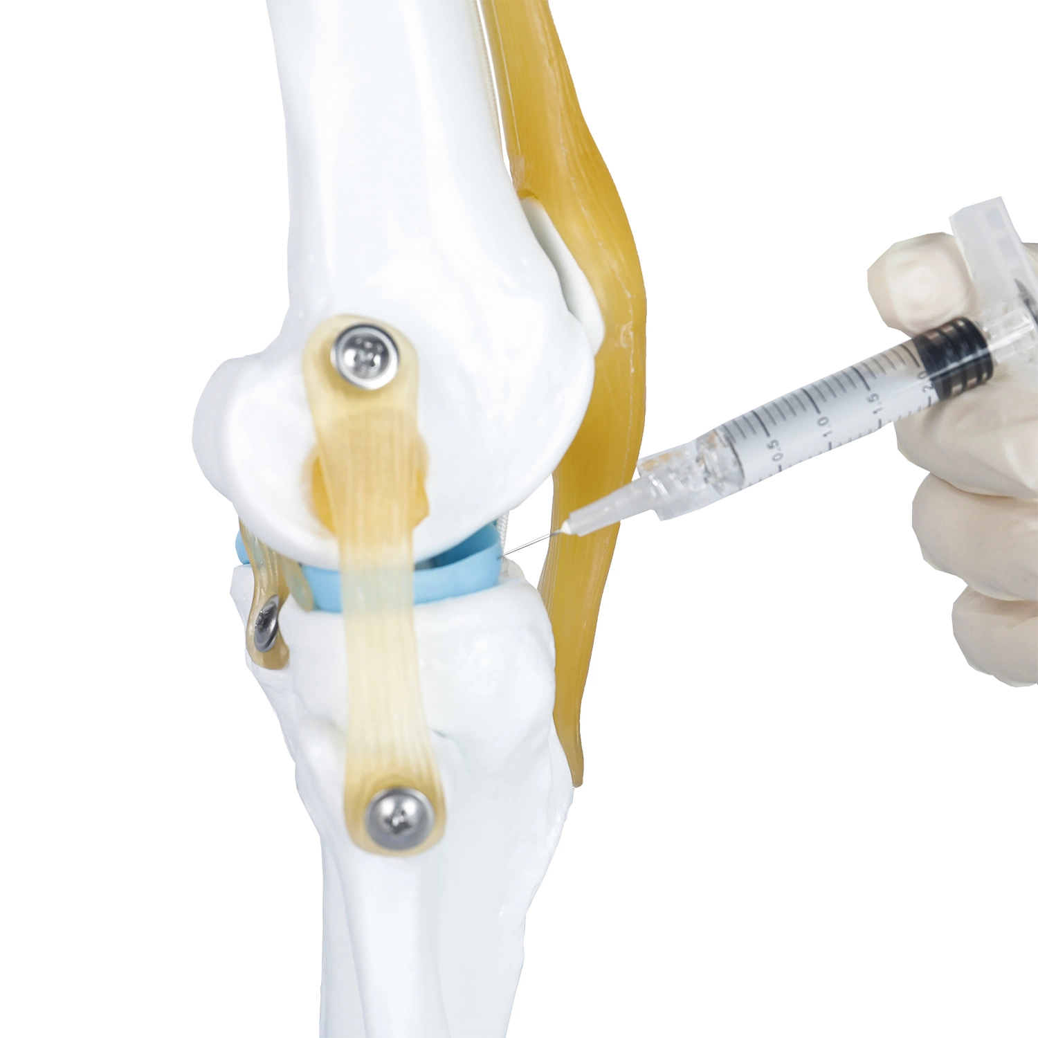 Medical Sodium Hyaluronate for Knee Injection