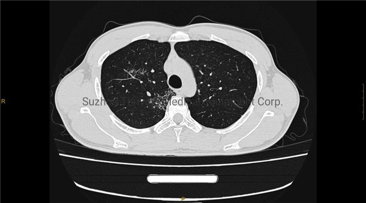 Medical Radiology Equipment CT Scan Machine Intelligent CT X-ray Scanner Machine 32 Slices