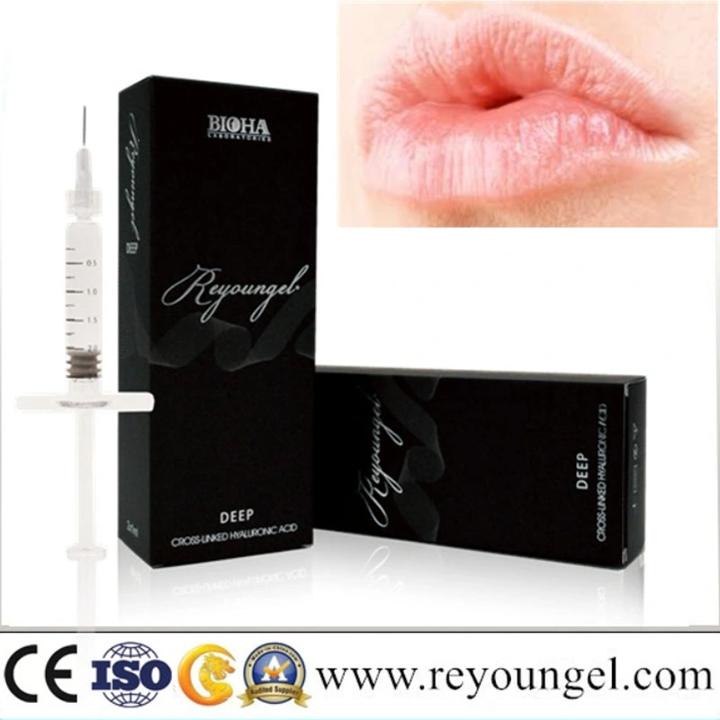 High quality/High cost performance  Injectable Hyaluronic Acid Dermal Filler for for Facial Filler Injections