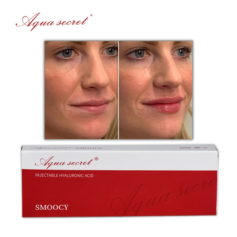 Aqua Secret Buy Injectable Lip Filler Hyaluronic Acid Gel to Remove Fine Lines