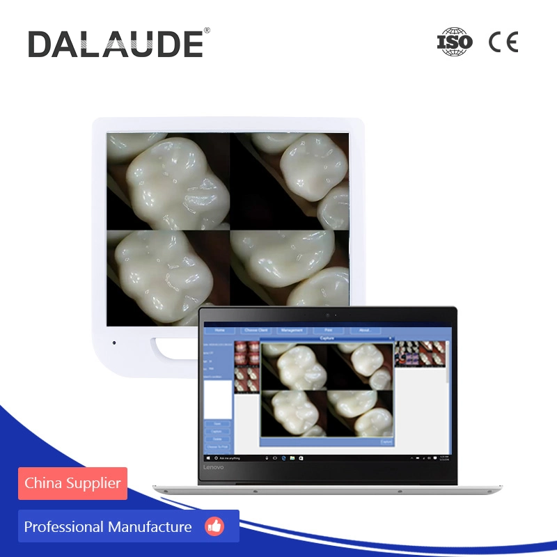 CE ISO Certificated Dental Intraoral Security Camera with Holder