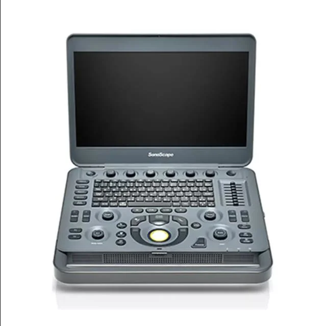 Hospital Laptop Type Sonoscape Advanced X3 High End Portable Cardiac Vascular Thyroid Scan Ultrasound Scanner