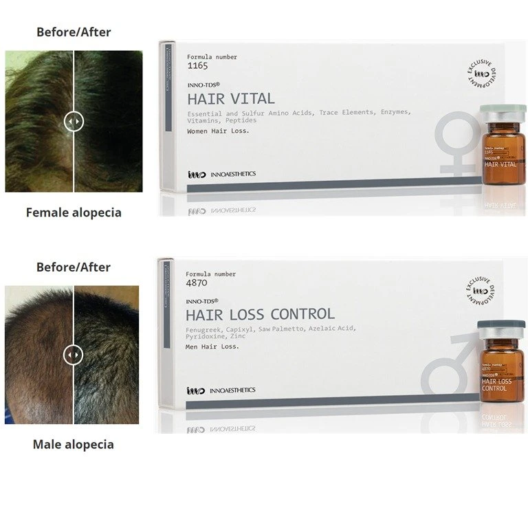 La marca original español Inno-TDS/Control de la pérdida de cabello Inno-TDS cabello masculino y femenino de vital importancia para el crecimiento del vello con resultados más rápidos