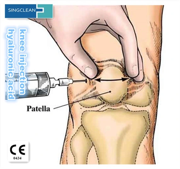 China Quickclean 3.0ml de gel, 20mg/ml el dolor de rodilla Singjoint lubricación mixta