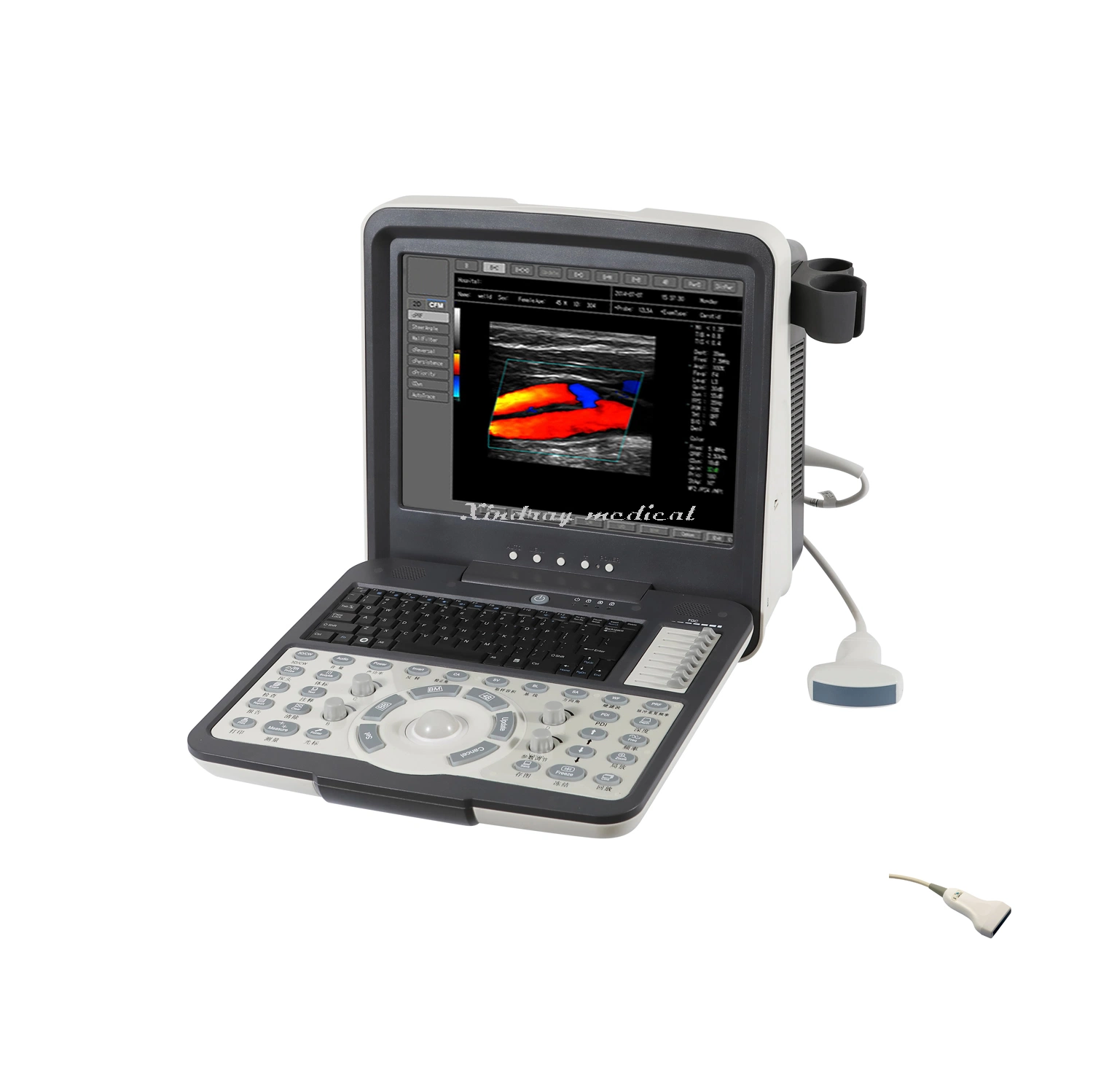 Hospital Medical Equipment Portable Color Doppler Ultrasound Scanner