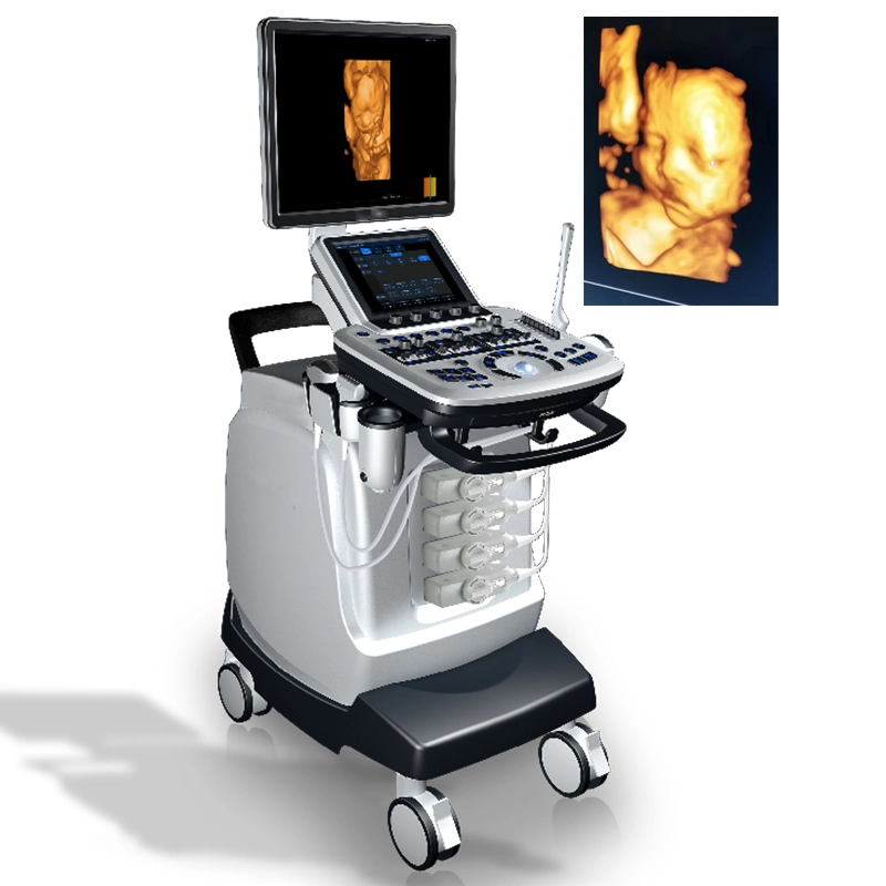 Medical Portable 4D da máquina de ultra-sonografia Doppler em cores