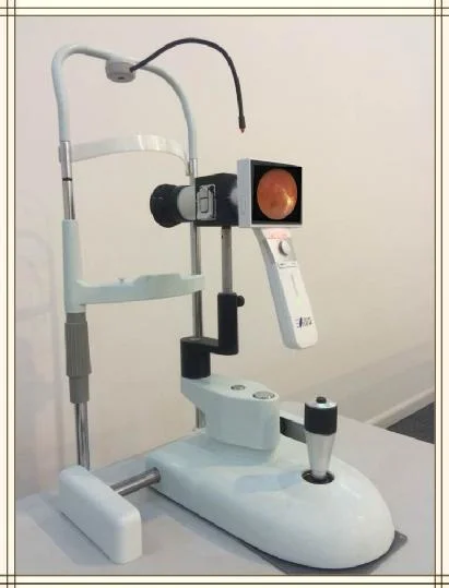 Ophthalmic Equipment Portable Digital Eye Fundus Camera