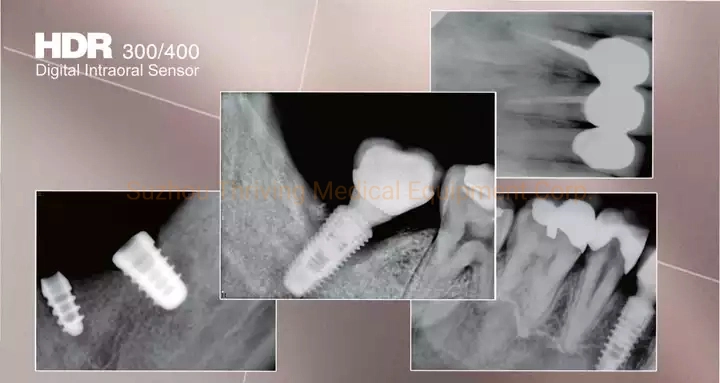 2022 Preço Barato Dental Digital do Sensor Sensor de raios-X dentário de imagem de raios-X dentário System