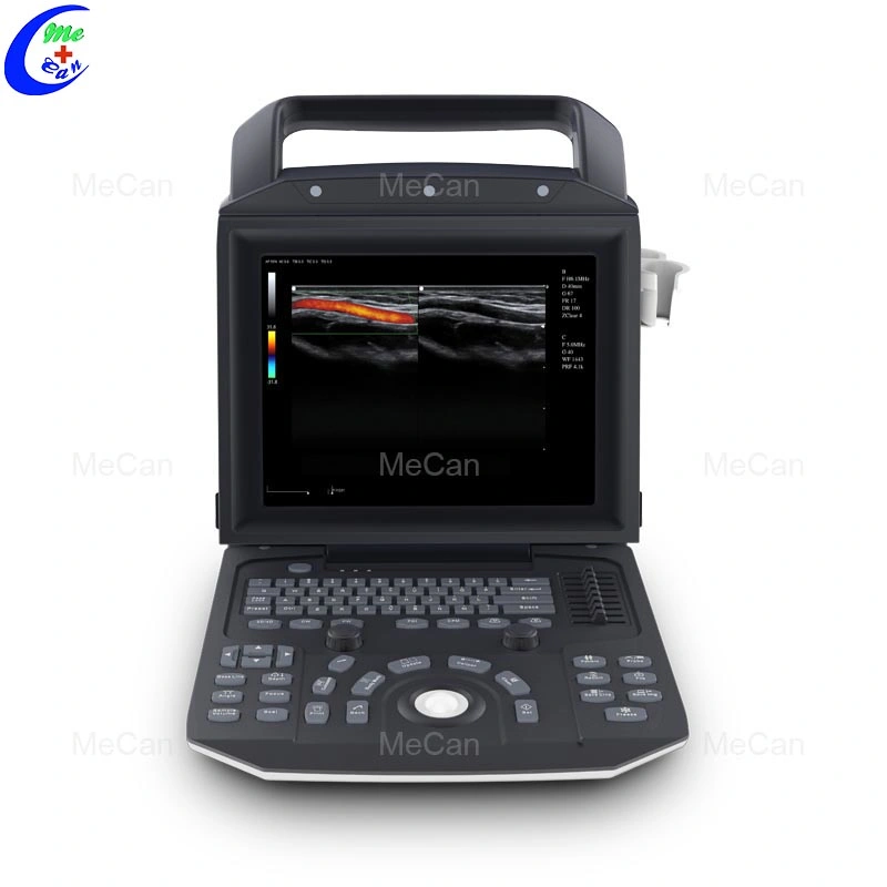 Ultrasonic Ultrasonido Portatil Medical Ecografo Portatil 2D/3D/4D Portable Color Doppler B Ultrasound